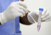 Saúde recebe notificação de 26 casos de coinfecção de influenza e covid-19