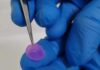 Biocurativo impresso em 3D é o futuro para tratar queimaduras