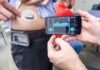 ‘Pâncreas artificial’ inglês ajuda pacientes em tratamento da diabetes