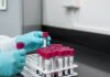 SUS vai combater doenças raras com novo laboratório
