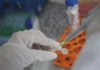 São Paulo vai testar vacina contra crack e cocaína feita pela UFMG