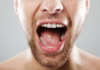 1° remédio que faz nascer novos dentes será testado em humanos