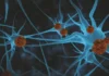 Novo remédio que retarda progressão do Alzheimer é eficaz, dizem especialistas da FDA